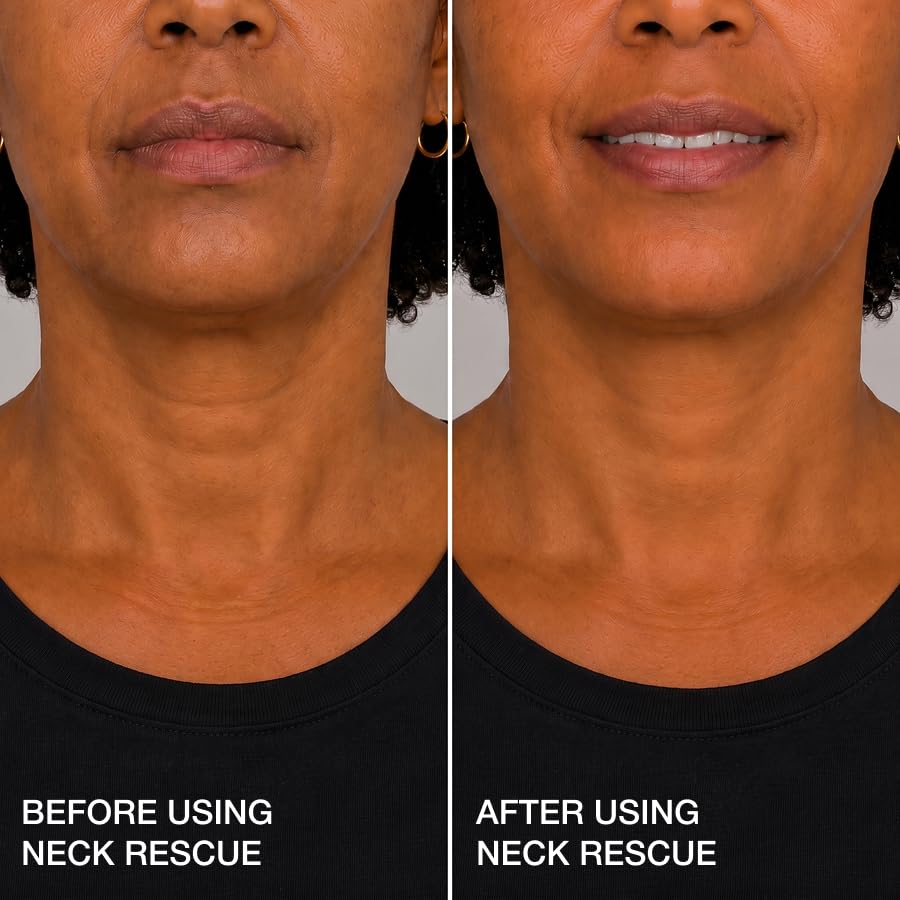 Contours Rx invisible placement behind neck demonstrating discreet smooth profile benefit