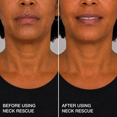 Contours Rx invisible placement behind neck demonstrating discreet smooth profile benefit