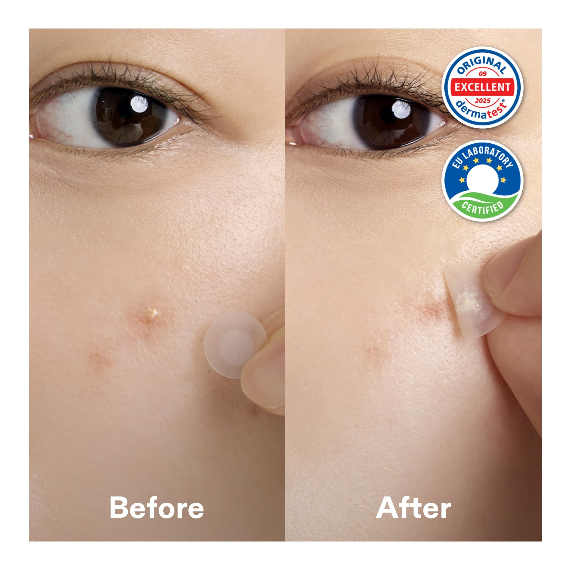Cordiale hydrocolloid center close-up highlighting absorption and protection