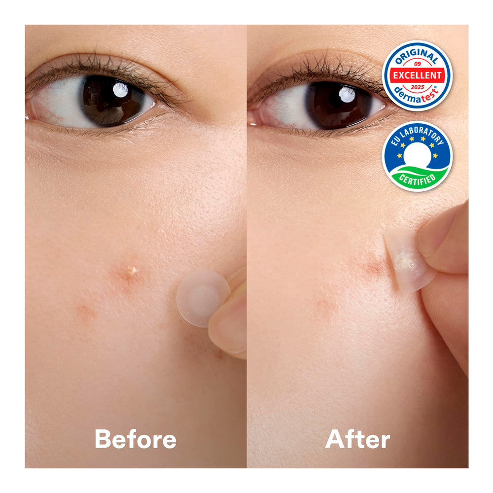 Cordiale hydrocolloid center close-up highlighting absorption and protection