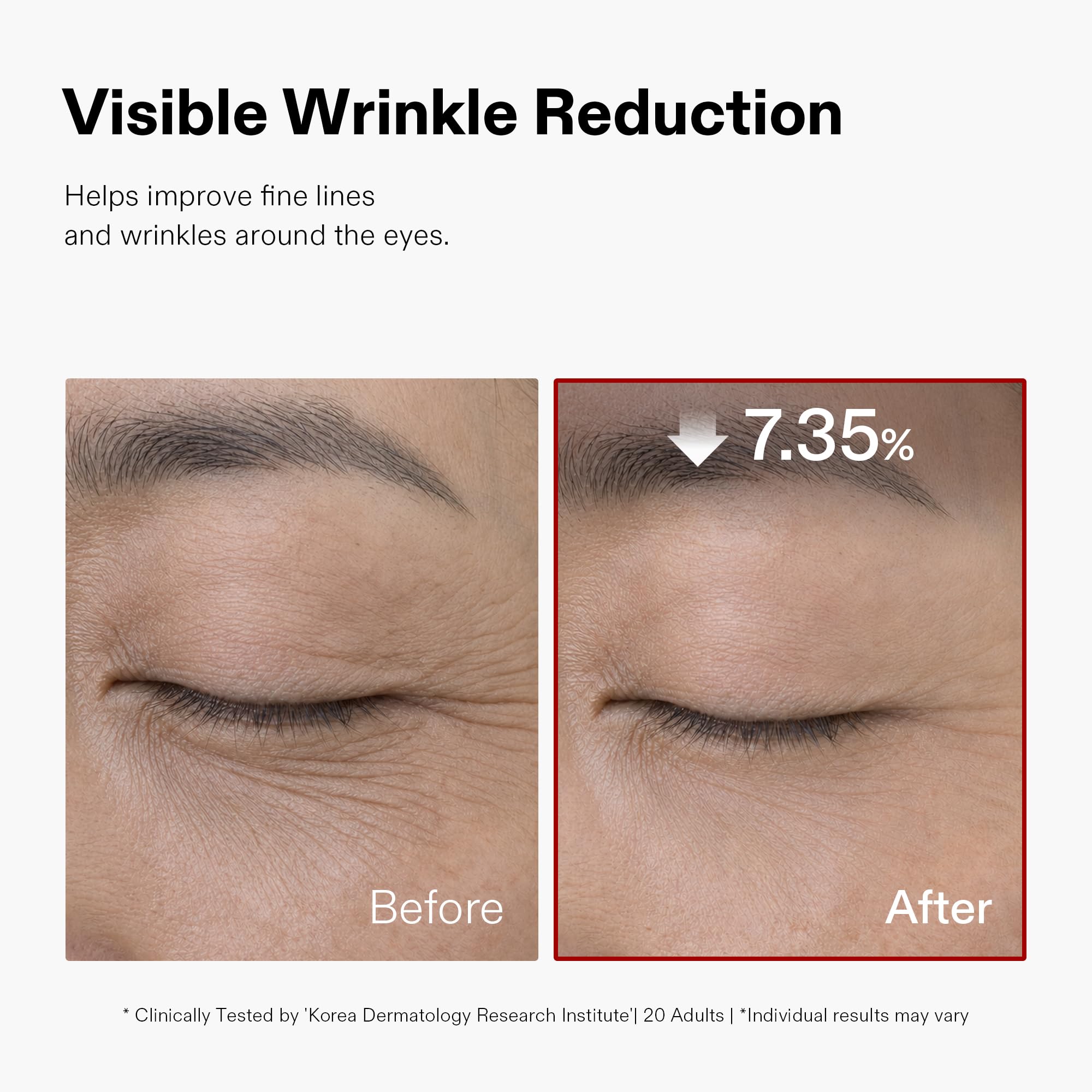 CORDIALE peptide complex diagram emphasizing wrinkle‑smoothing benefit
