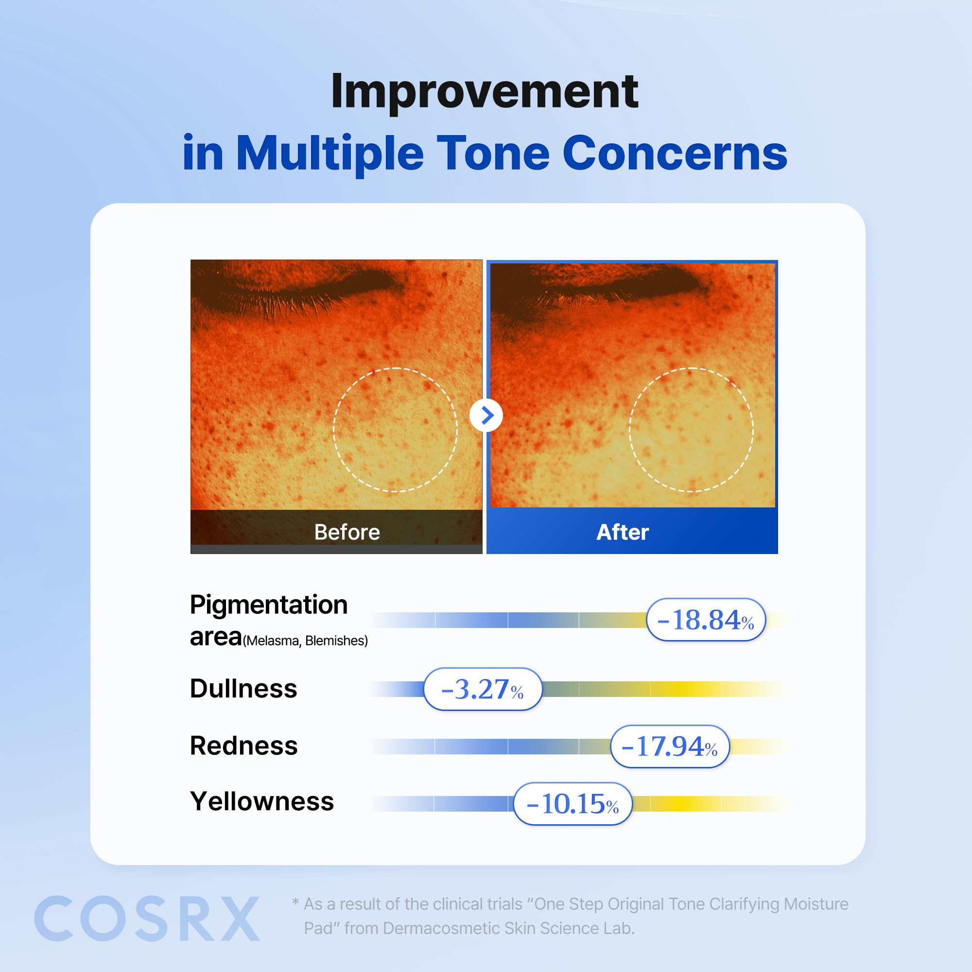 COSRX pad applied around nose showing precise fit and even absorption