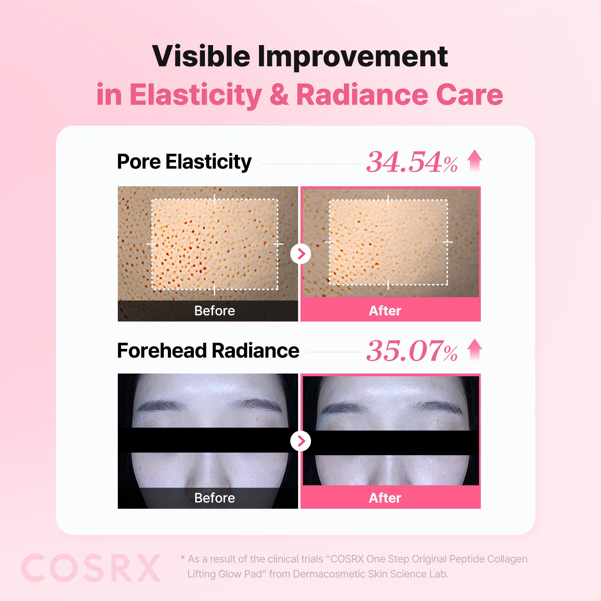 COSRX pad applied to cheek demonstrating cooling, de-puffing effect