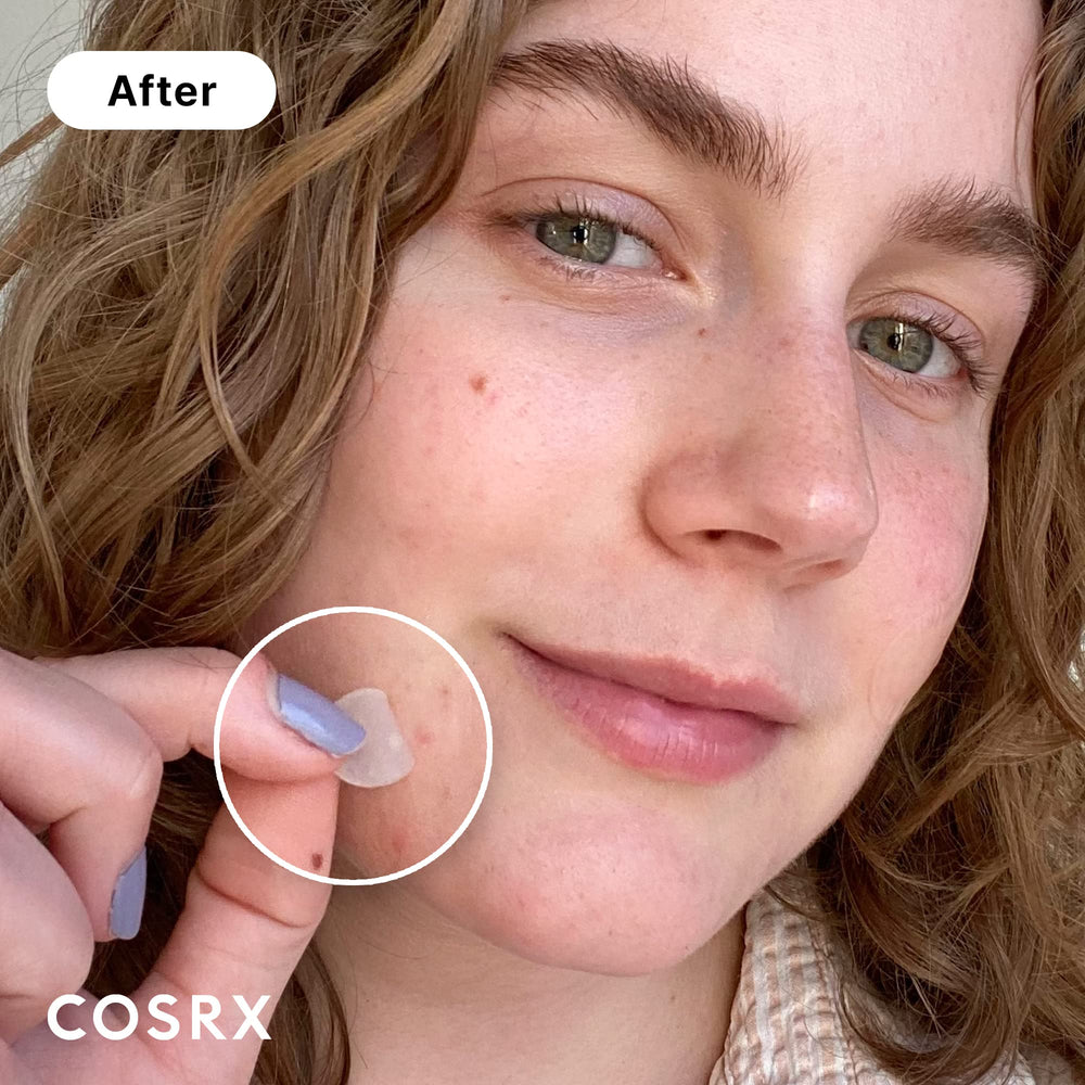 COSRX three patch sizes arranged to show coverage options and versatility