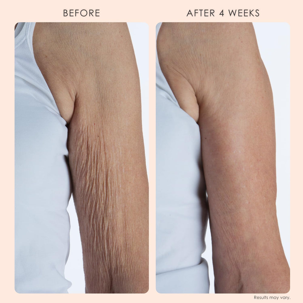 Crepe Erase being smoothed onto arm demonstrating fast absorption and improved texture