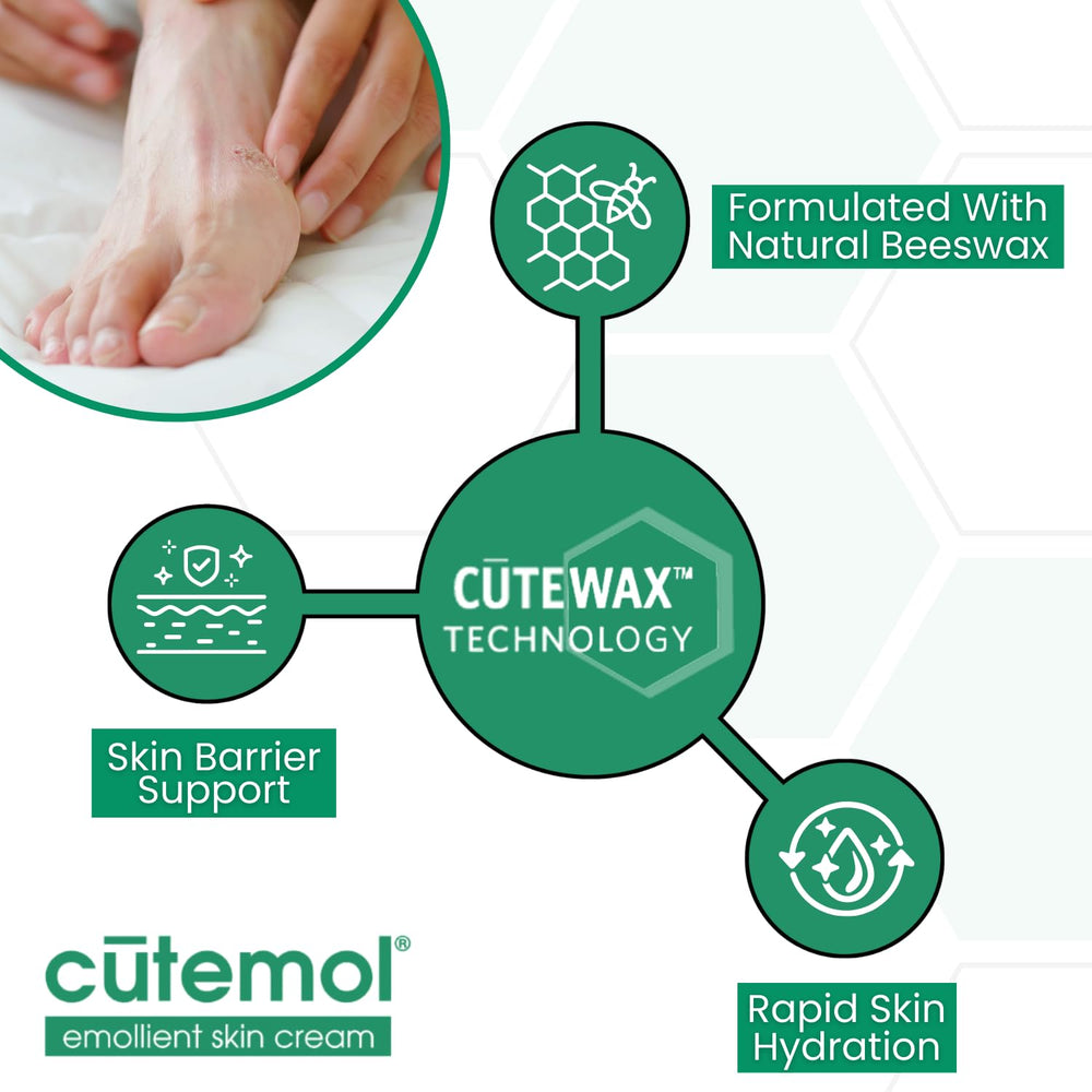 Cutemol treating heels showing targeted use for cracked feet moisture