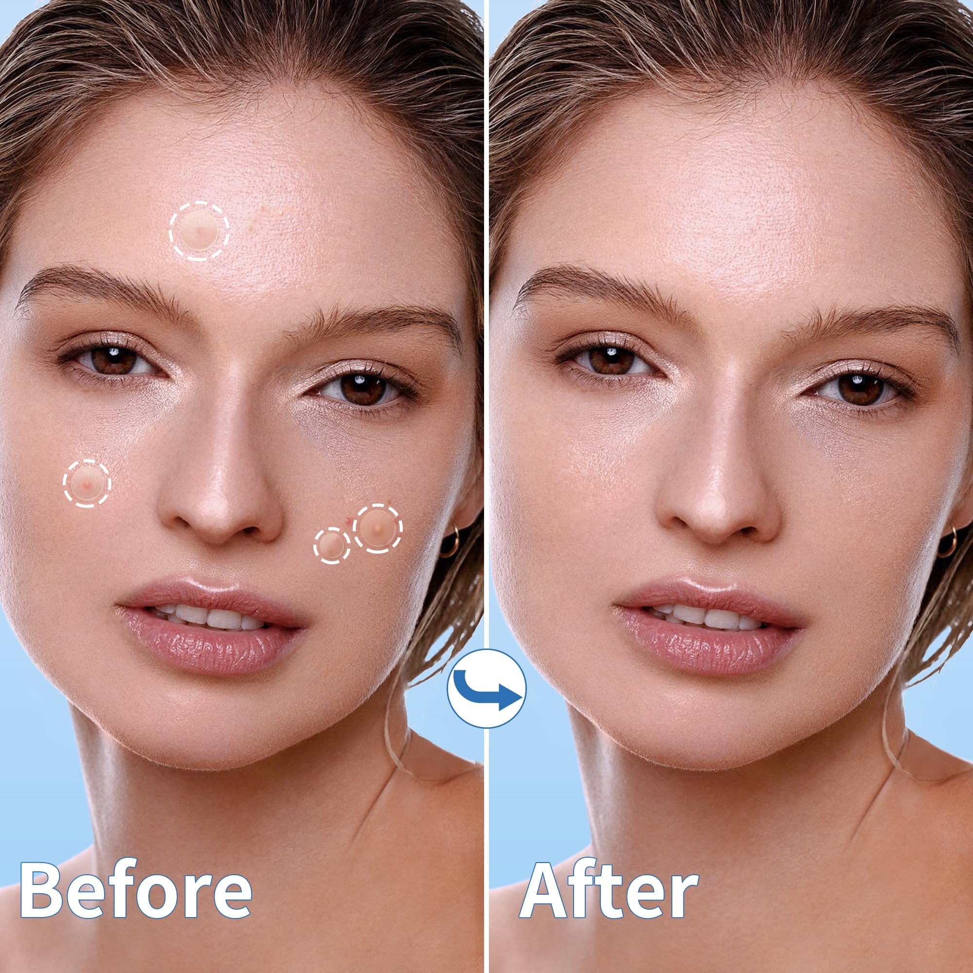 Daolyo patch applied on cheek demonstrating discreet daytime wear