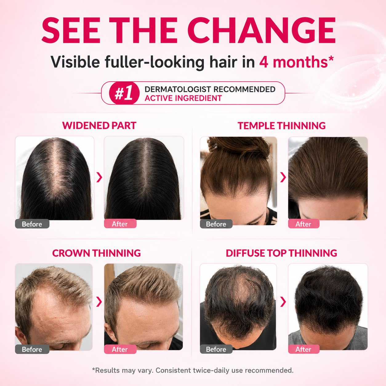 DAVV droplet on scalp close detail showing fast absorption benefit