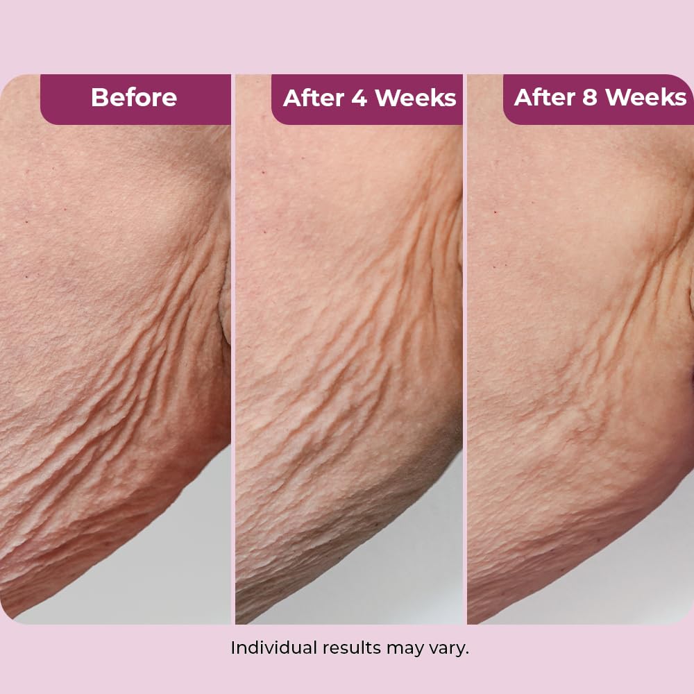 DEKLIDERM applying cream to neck for firmer-looking skin