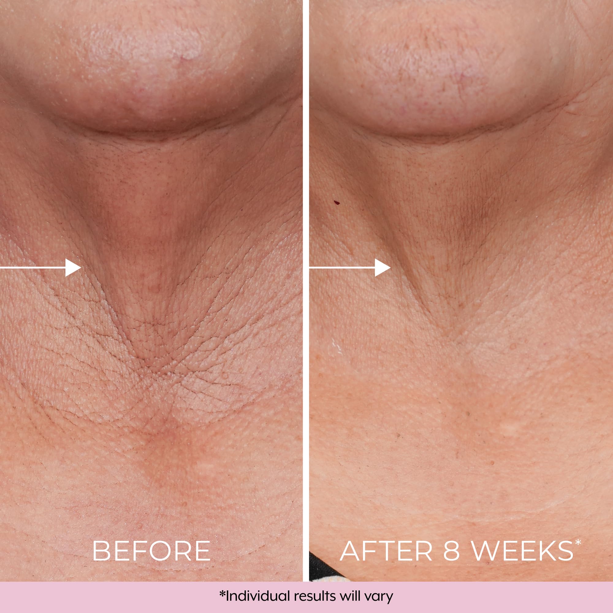 DEKLIDERM ingredient display of retinol and bakuchiol supporting renewal