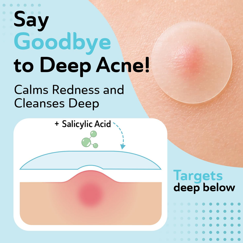 DERMA ANGEL patch applied to cheek demonstrating discreet coverage benefit