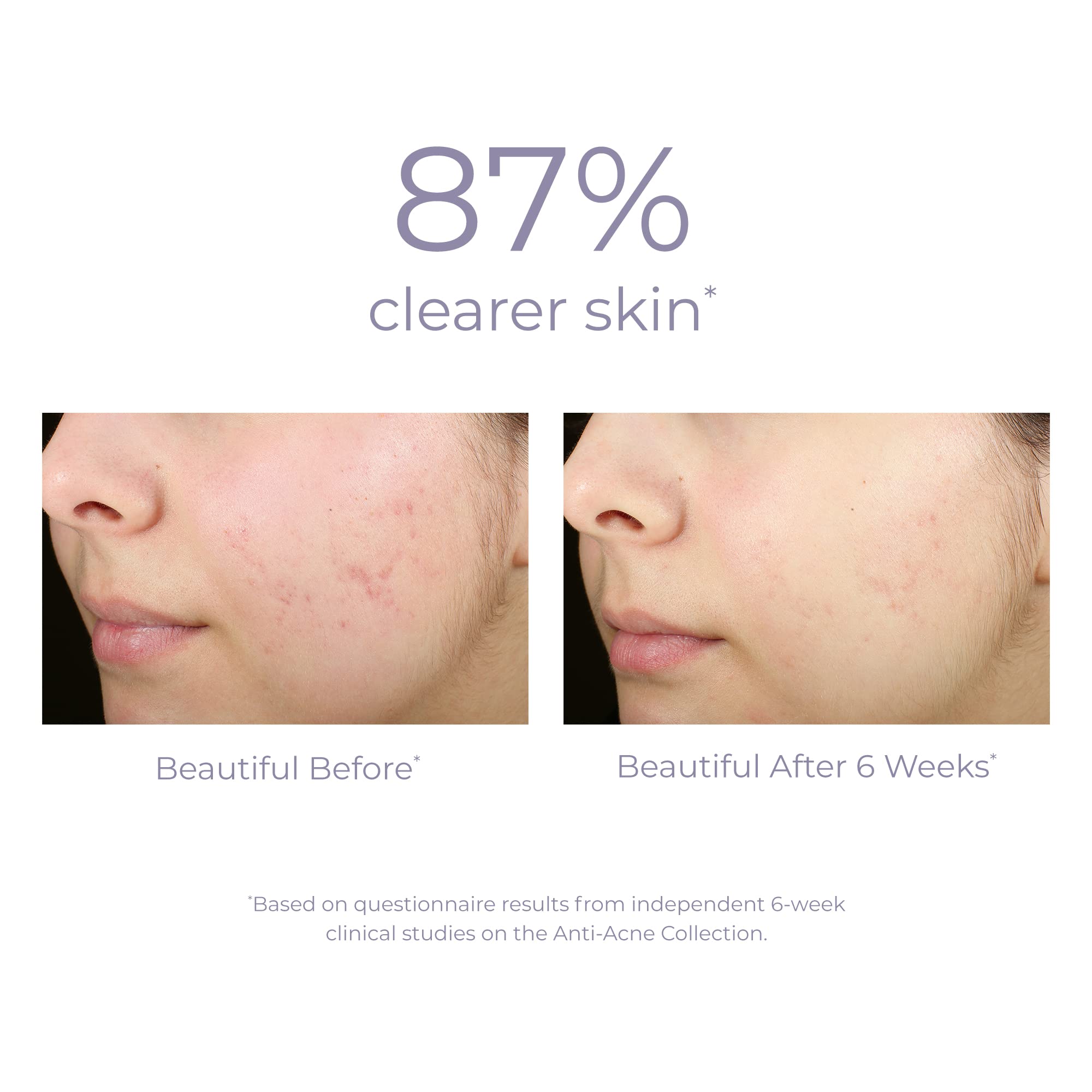 Derma E close-up label highlighting 2% salicylic acid and natural formula