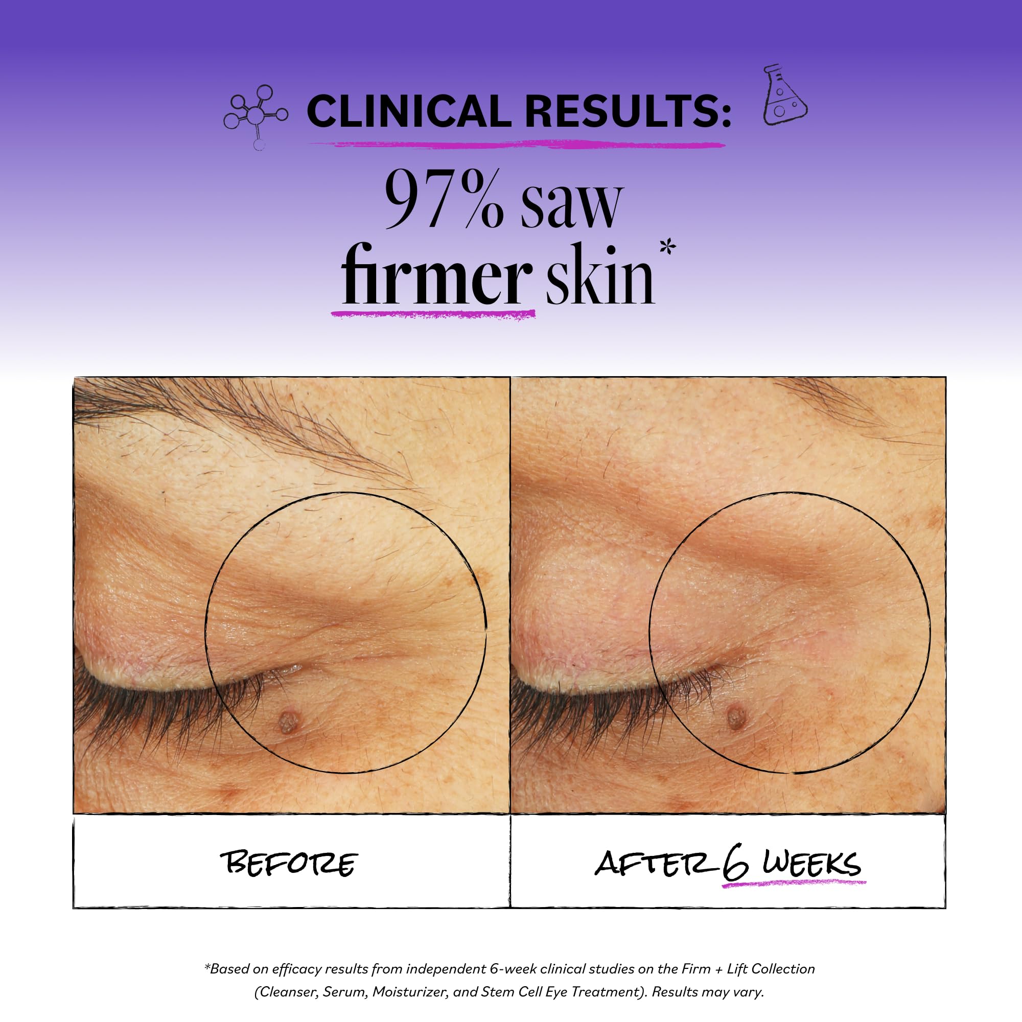 Derma E cream on fingertip ready to apply, precise dosing and gentle patting benefit