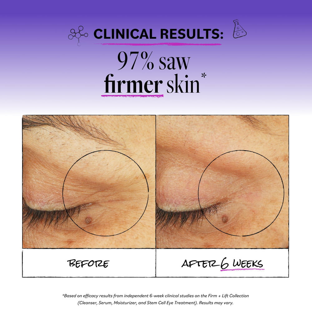 Derma E cream on fingertip ready to apply, precise dosing and gentle patting benefit