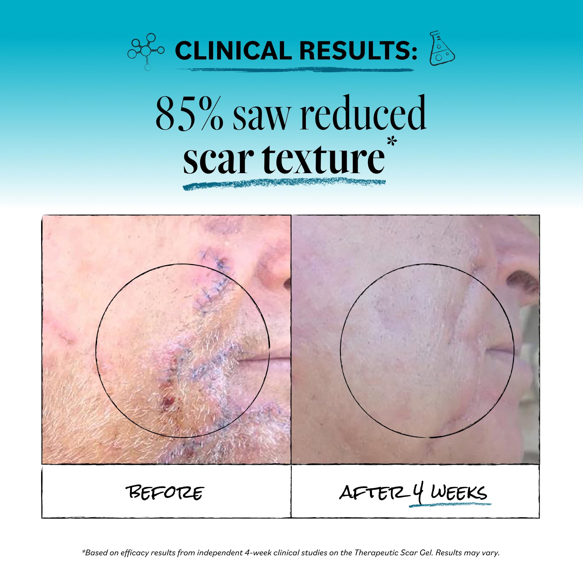 Derma E before and after comparison illustrating smoother appearance