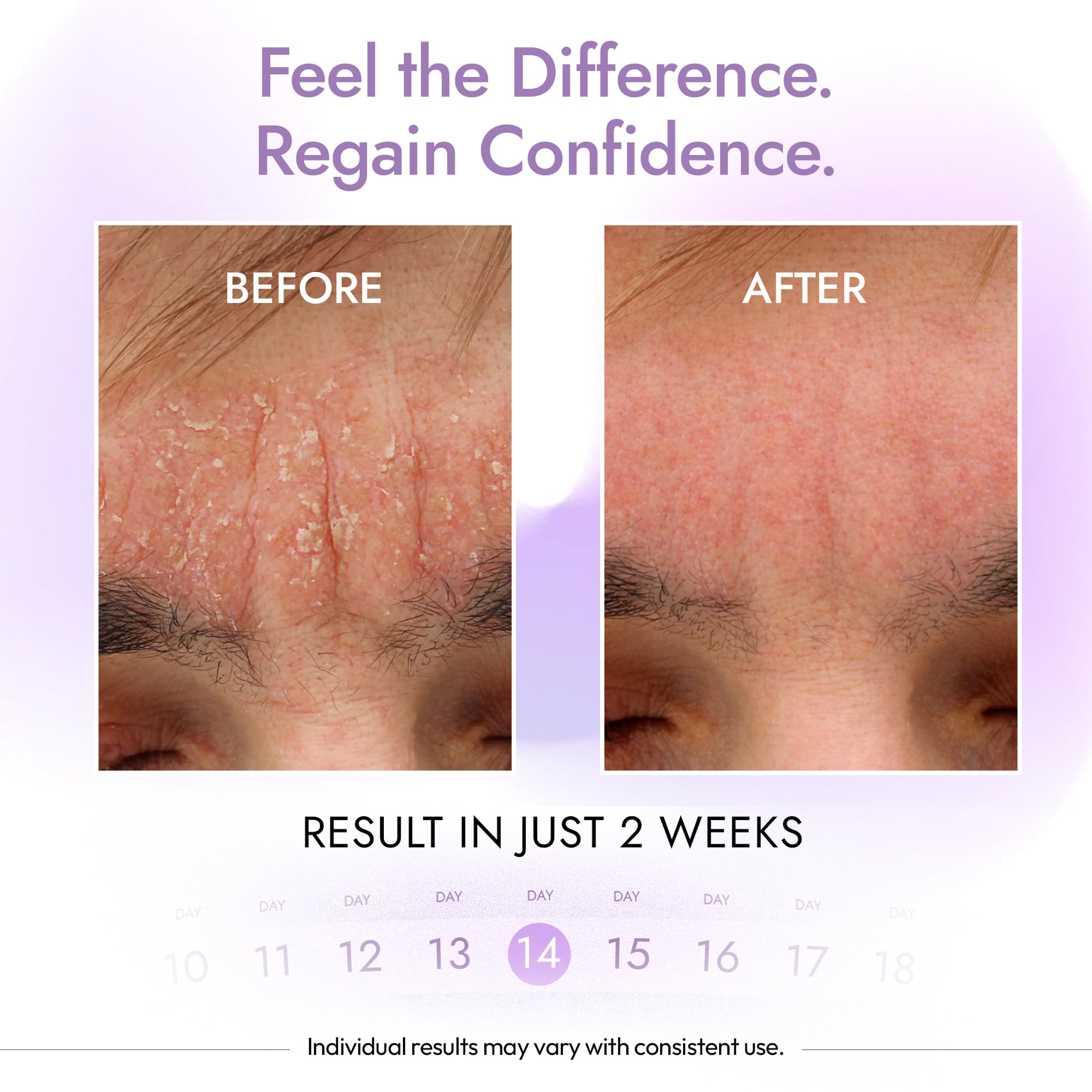 DERMAdoctor applying cleanser to scalp highlighting targeted dandruff care benefit