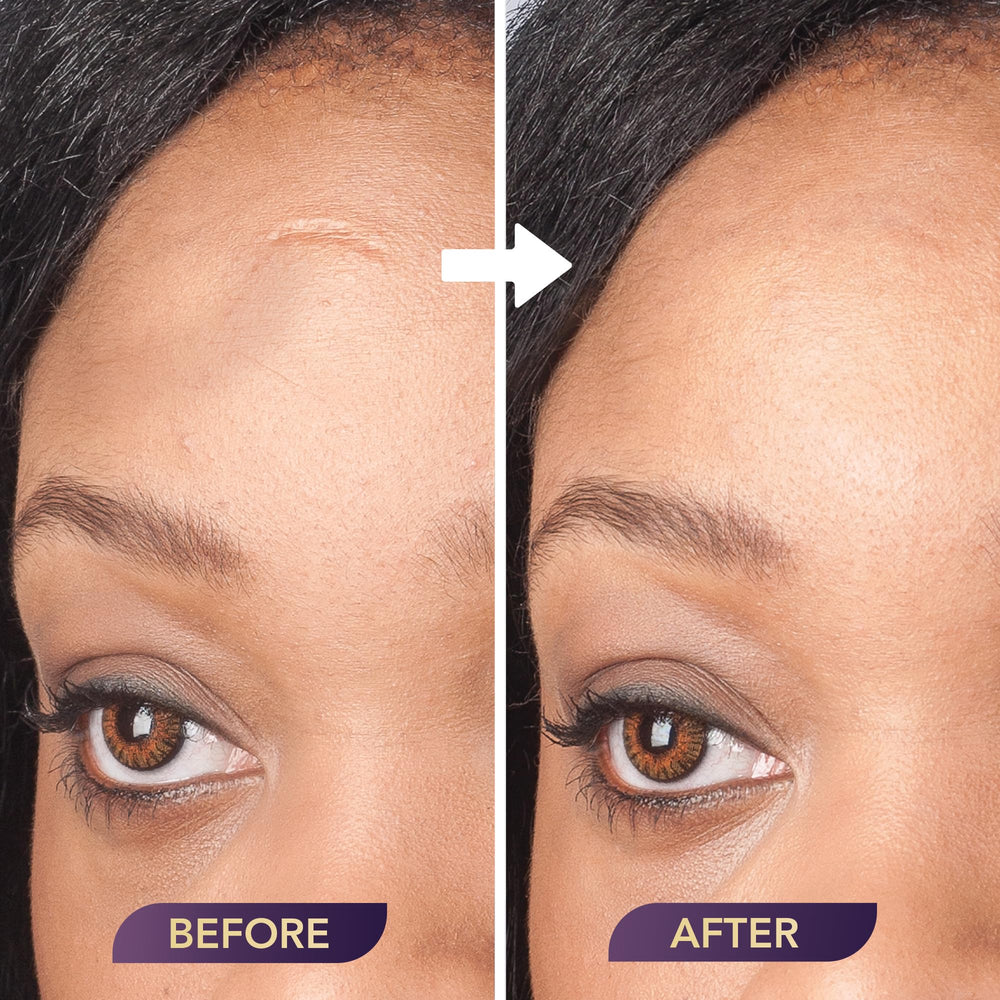 Dermaflage primer with concealer setup showing pairing for longer-lasting coverage benefits
