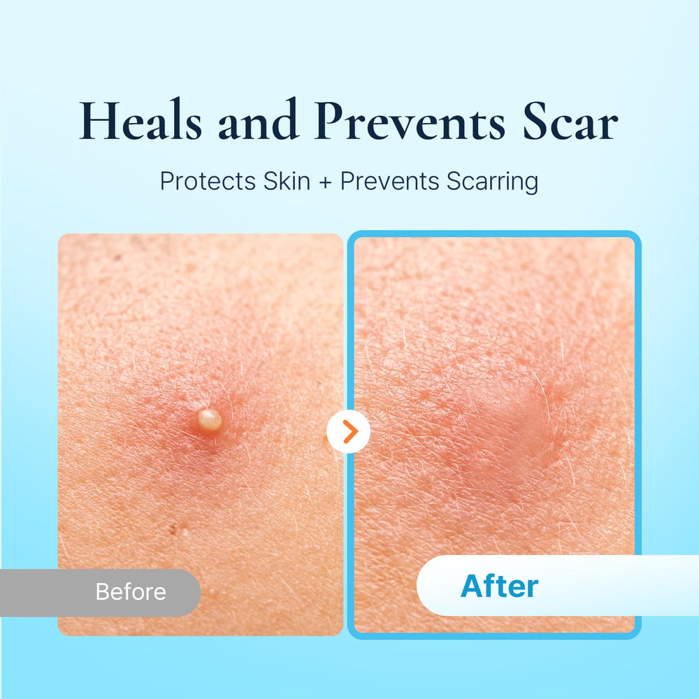 DERMAKR patch worn on cheek blending into skin discreetly