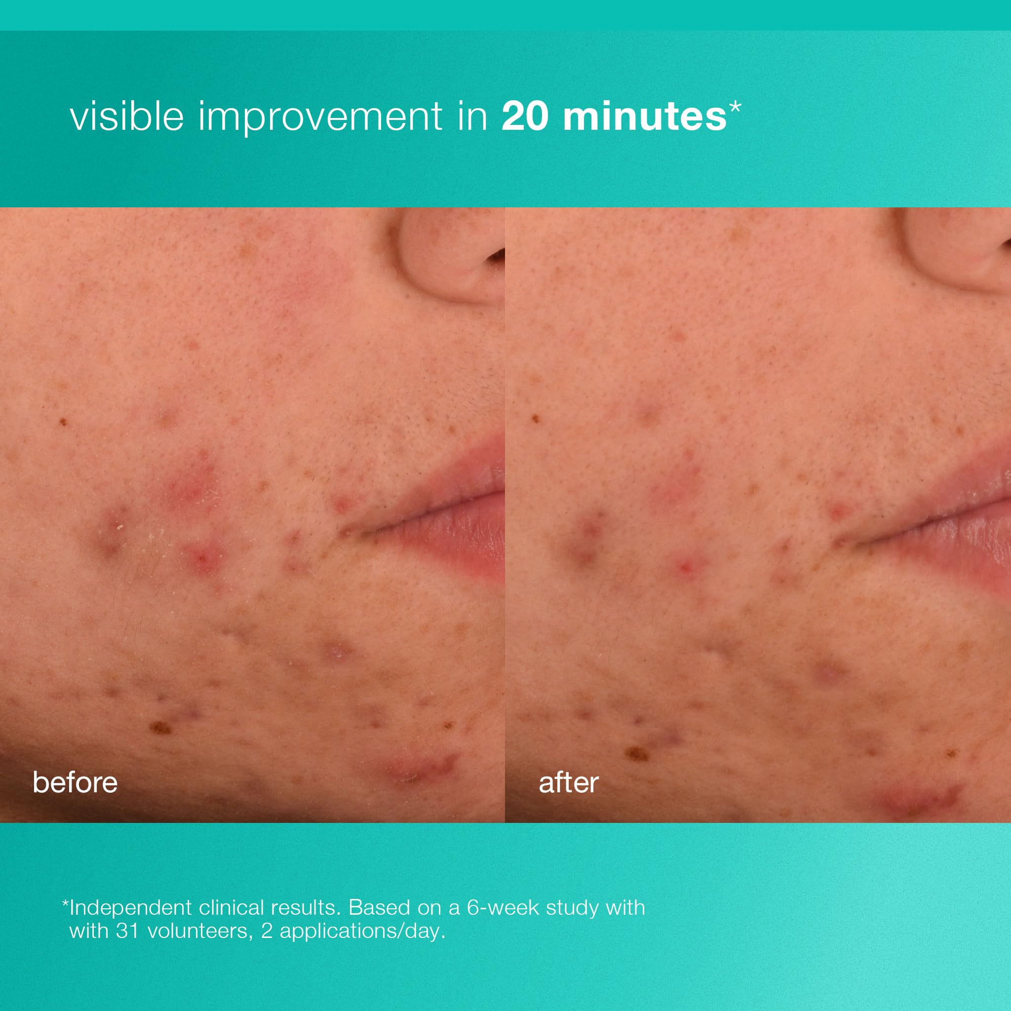 Dermalogica gel on hand close-up demonstrating non-greasy feel and immediate hydration benefit