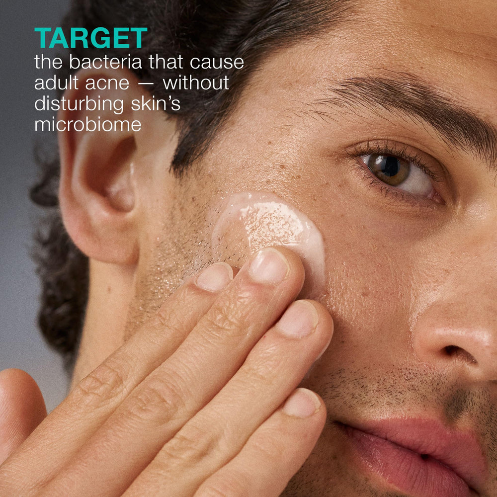 Dermalogica salicylic acid illustration showing active concentration and pore-clearing purpose