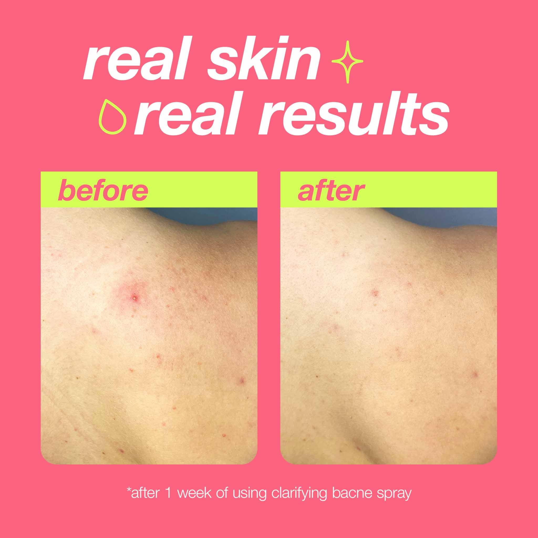 Dermalogica applied on a model's back showing reach for hard-to-reach areas