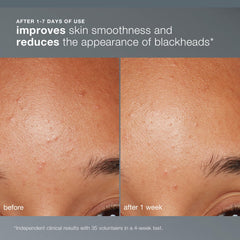 Dermalogica paste formed in hand showing creamy texture and smooth skin benefit