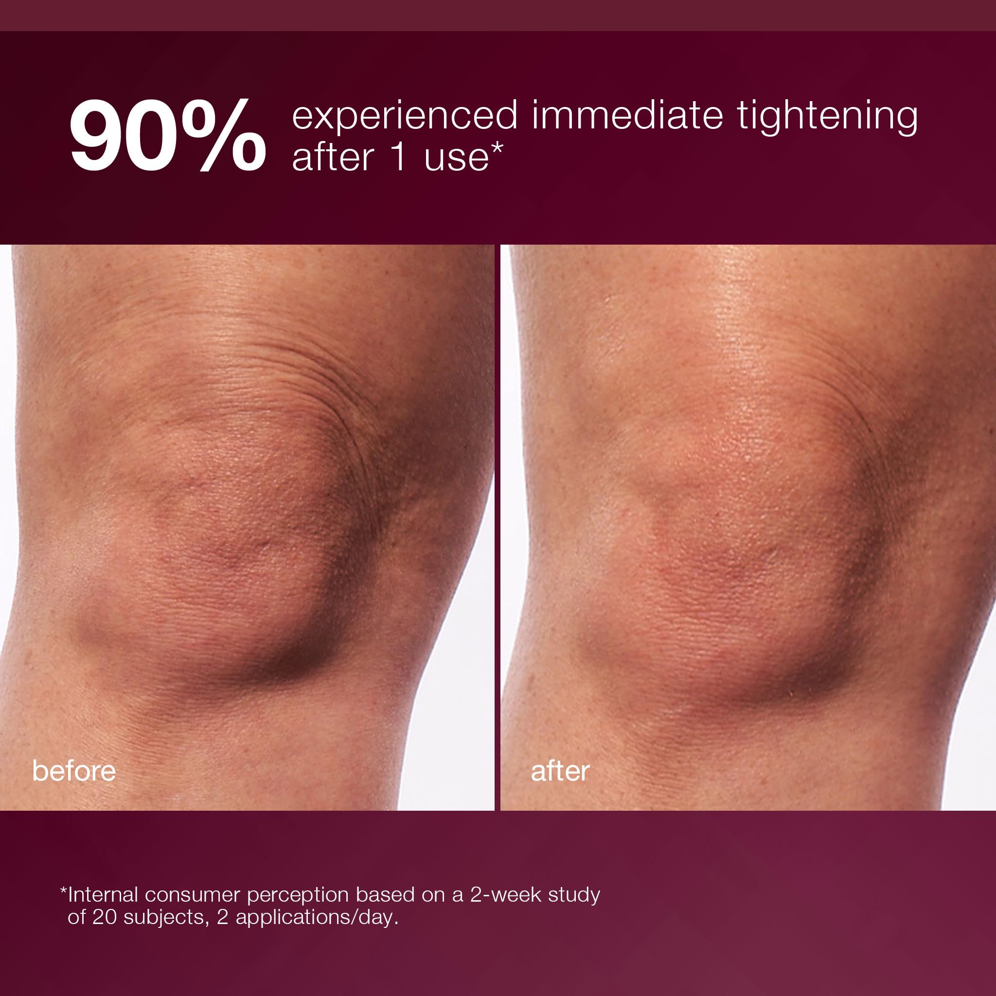 Dermalogica applying serum to arm for firmer-looking, hydrated skin