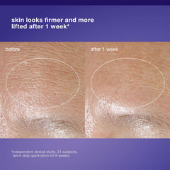 Dermalogica cream being dispensed on hand for easy application