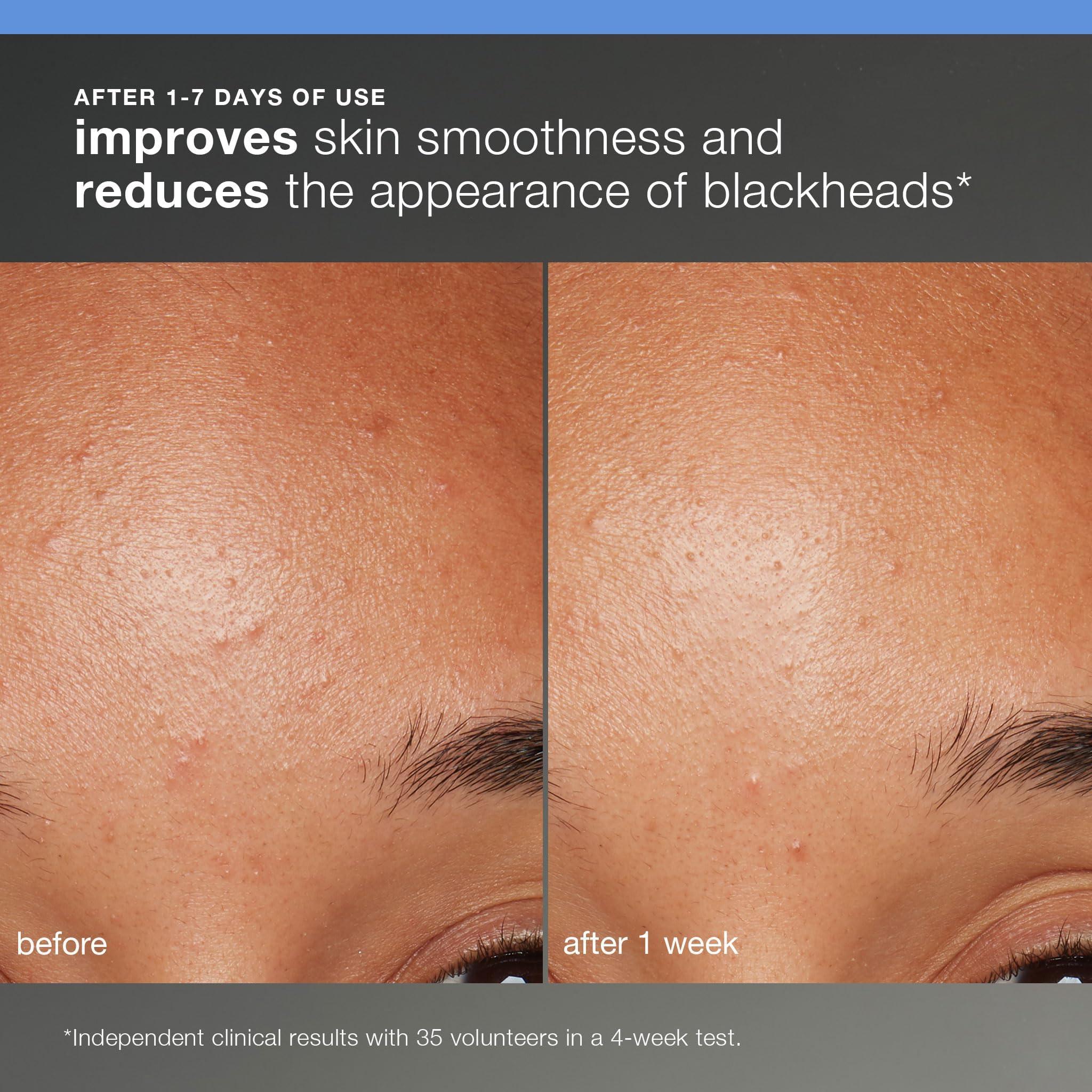 Dermalogica Skin Smoothing Cream open jar showing lightweight hydration