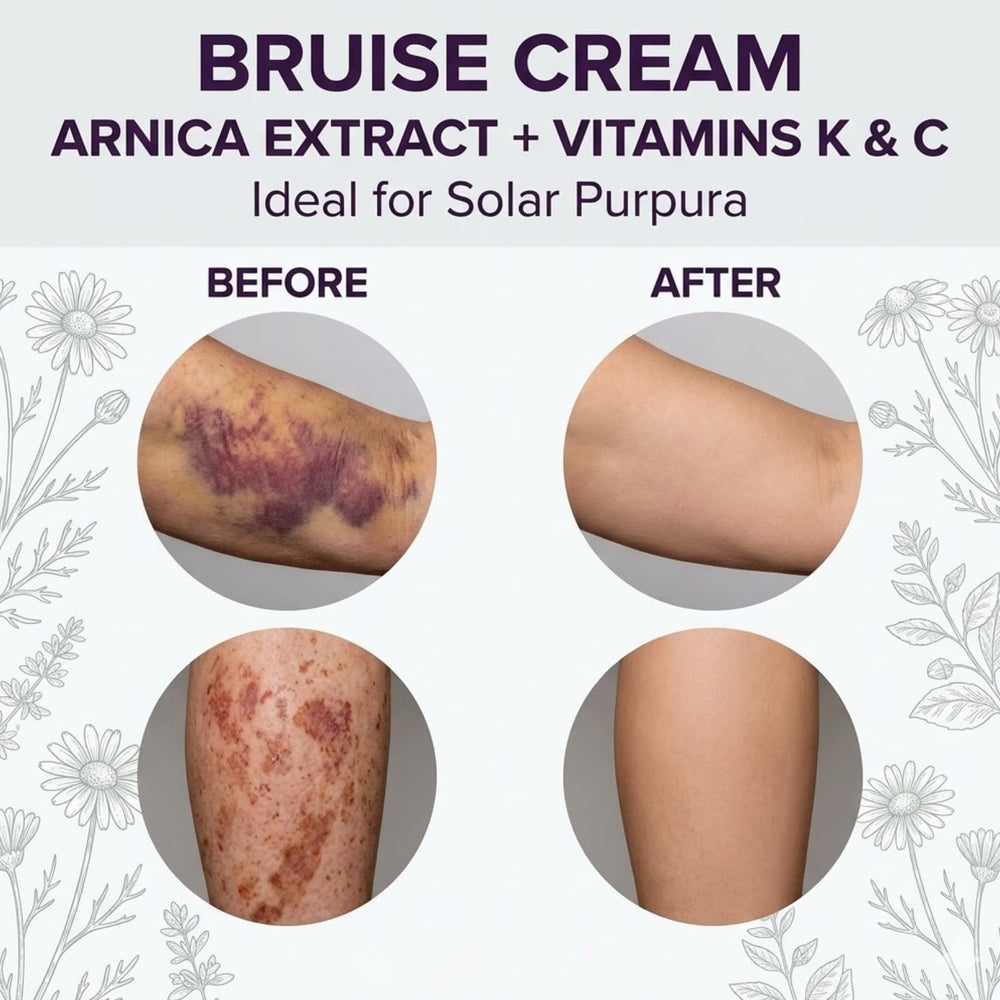 Dermara bruise cream in hand demonstrating the 4 oz size and easy portability
