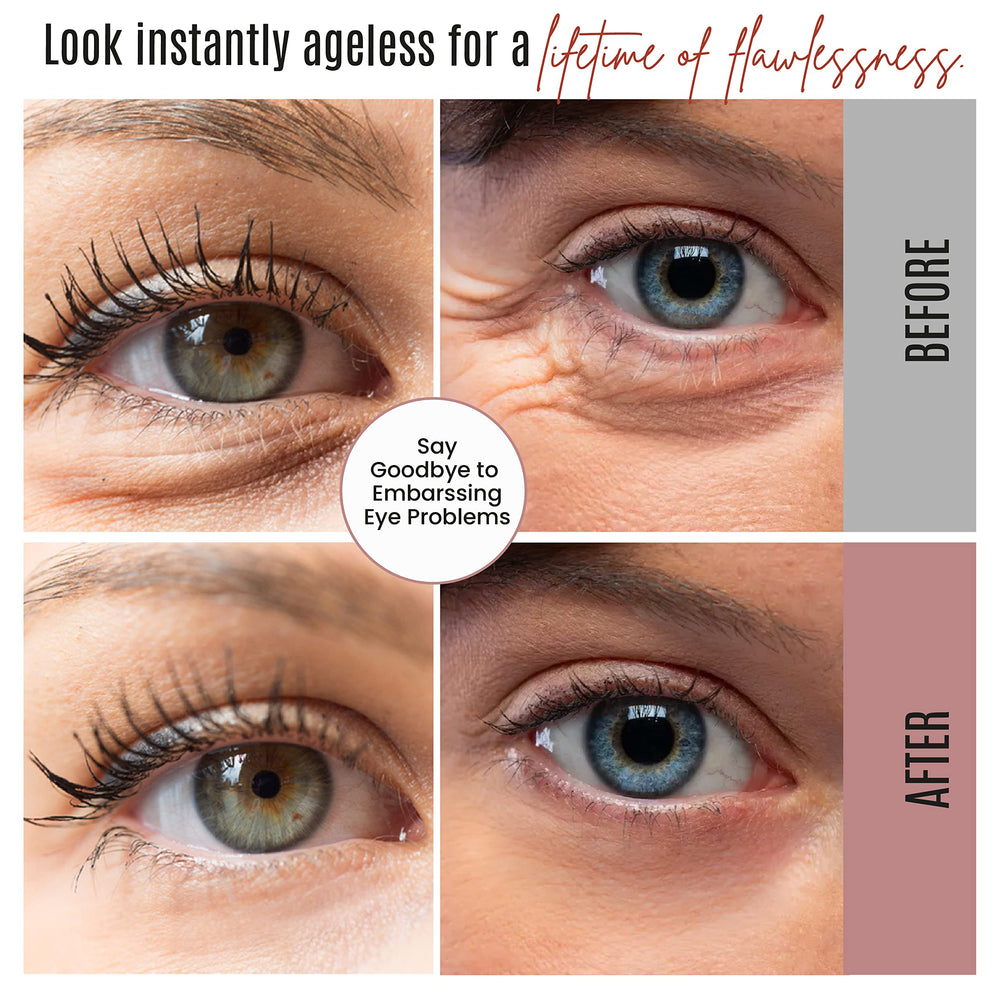 DERMAXGEN before and after under-eye comparison for visible lift
