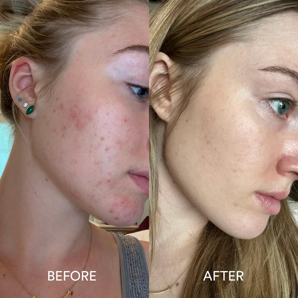 Dermazen absorbed into skin close-up showing non-greasy finish