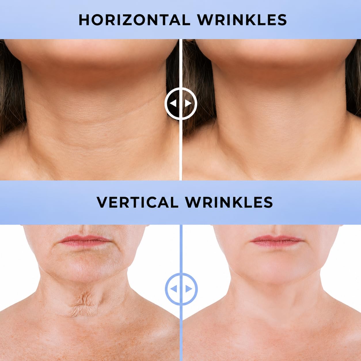 DERPHEA lifestyle shot of chin and jawline use, conveys visible smoothing benefit