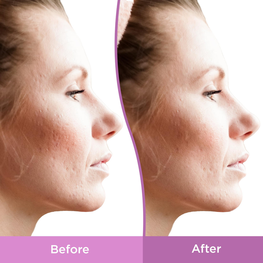 Differin label listing bakuchiol and peptides to show gentle resurfacing benefits