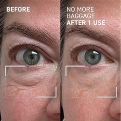 Dr. Brandt before and after comparison showing reduced puffiness and brighter eyes