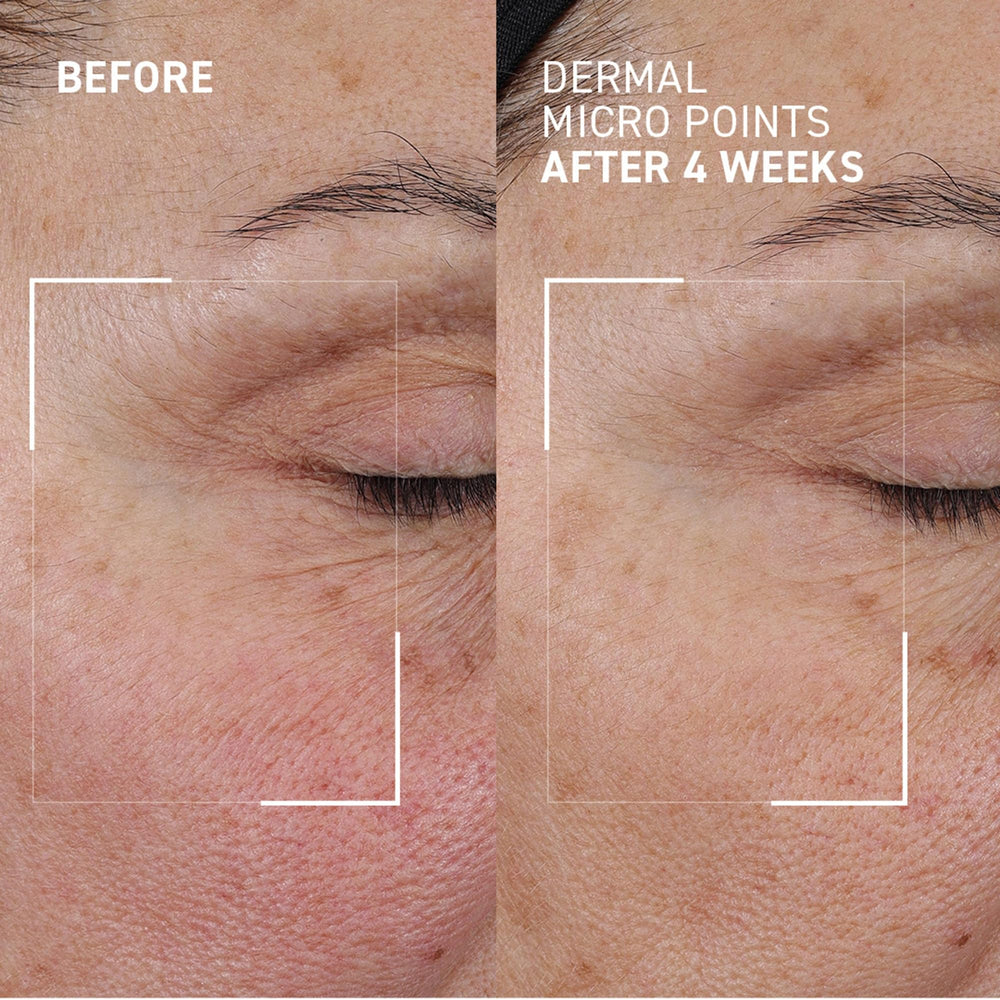 Dr. Brandt gel spread on skin emphasizing lightweight texture and absorbency