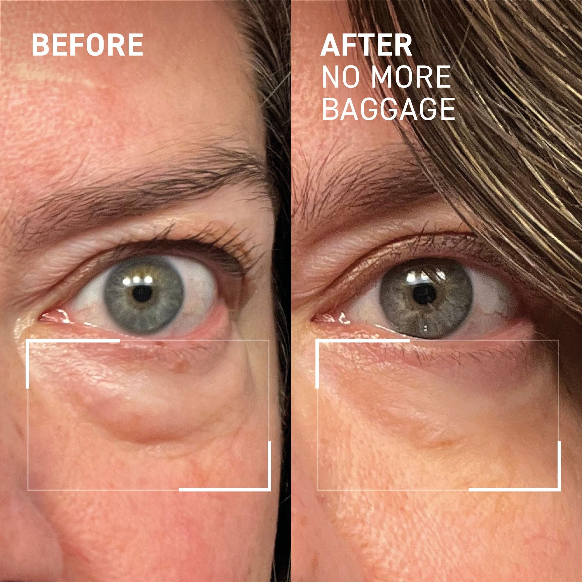 Dr. Brandt blended with makeup showing compatibility and camera-ready benefit