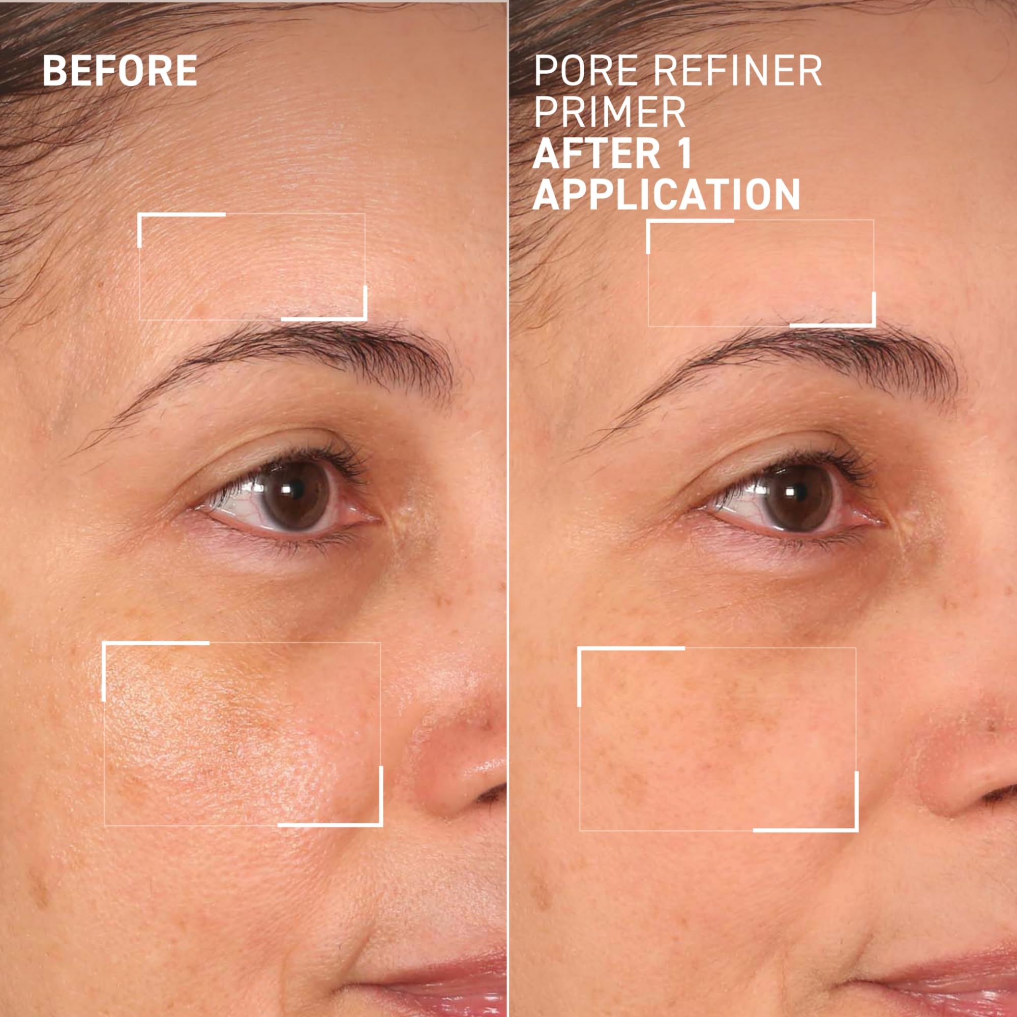 Dr. Brandt tinted variant displayed to show subtle coverage option