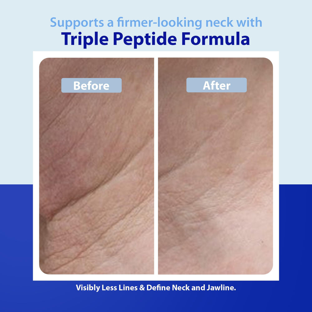 Dr. Denese cream being applied to neck demonstrating gentle lifting effect
