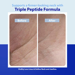 Dr. Denese cream being applied to neck demonstrating gentle lifting effect
