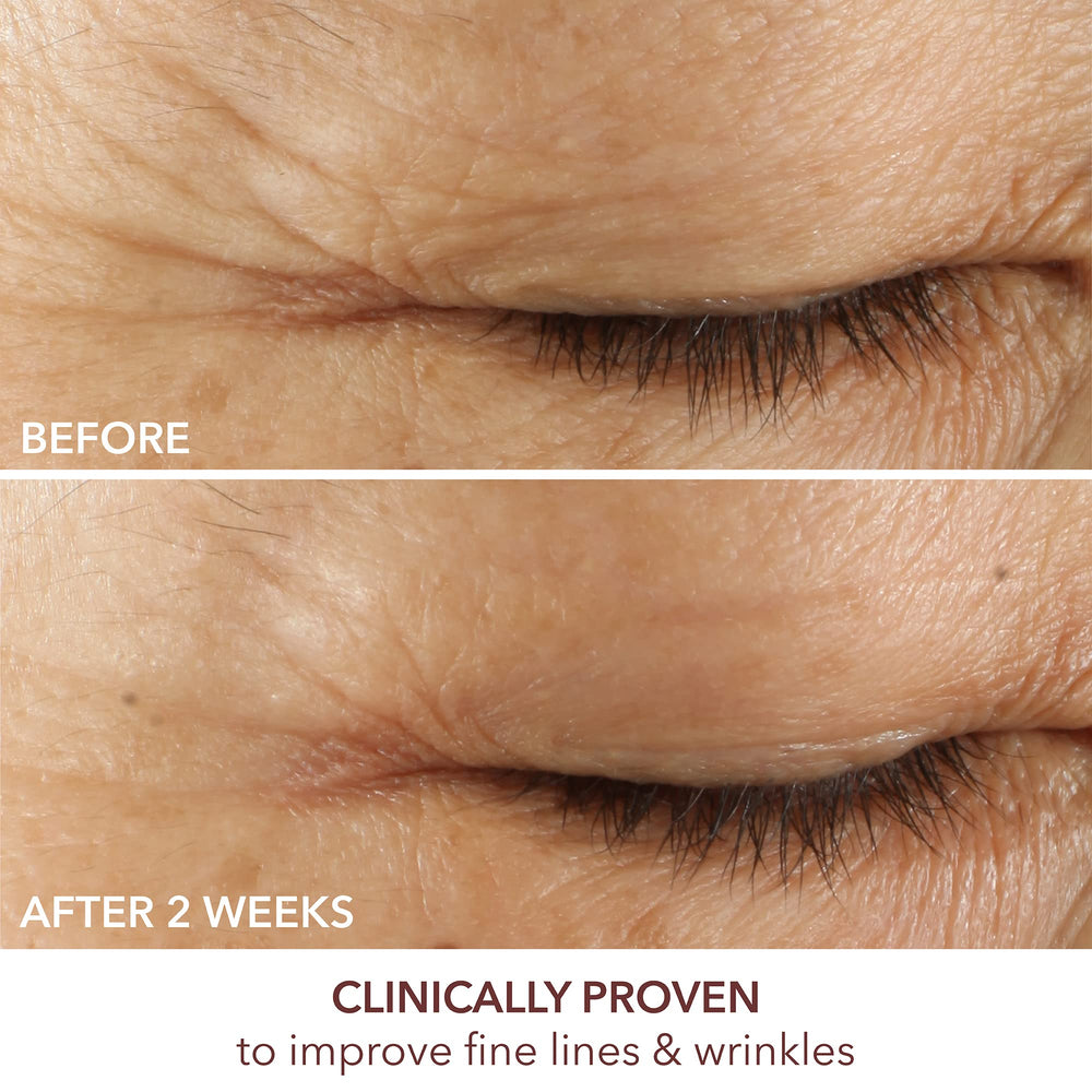 Applying Dr Dennis Gross serum under eye demonstrating gentle targeted application