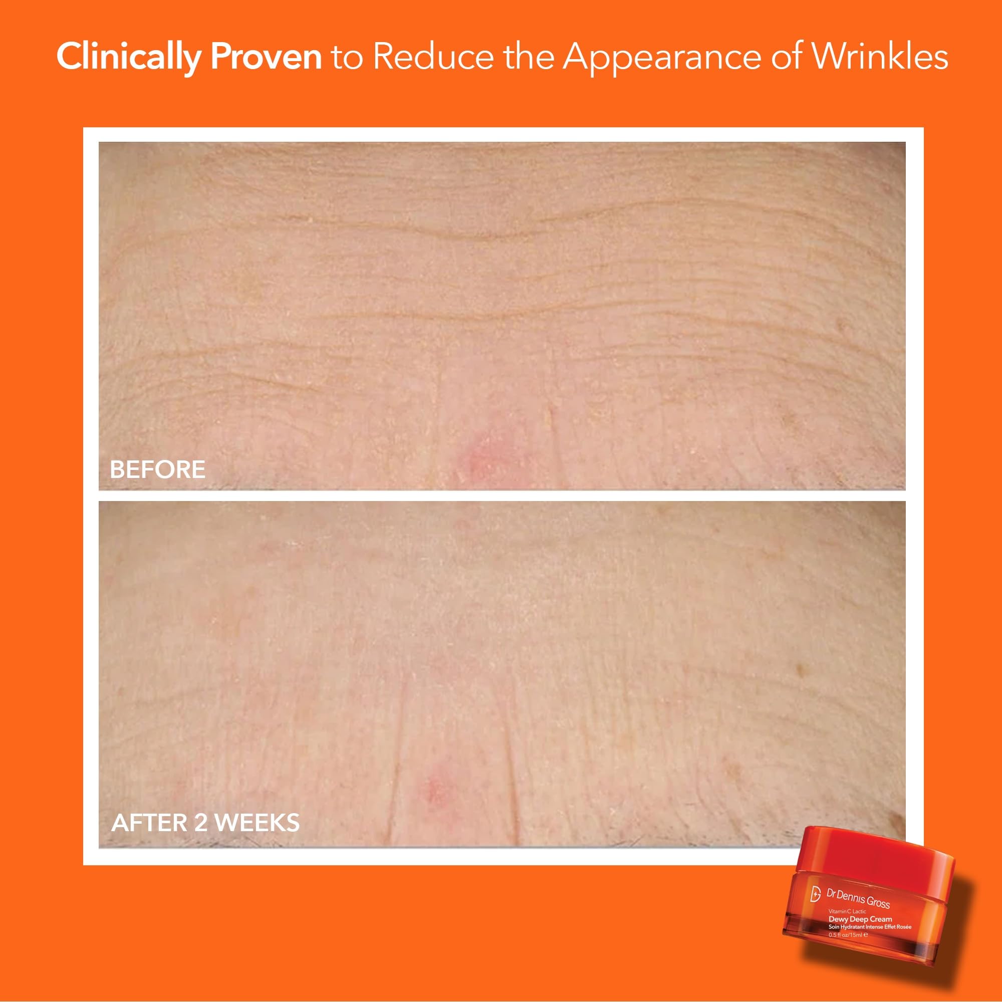 Flatlay showing improved skin texture after Dr Dennis Gross routine