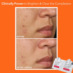 Dr Dennis Gross Step 2 pad detail showing antioxidant-rich formula