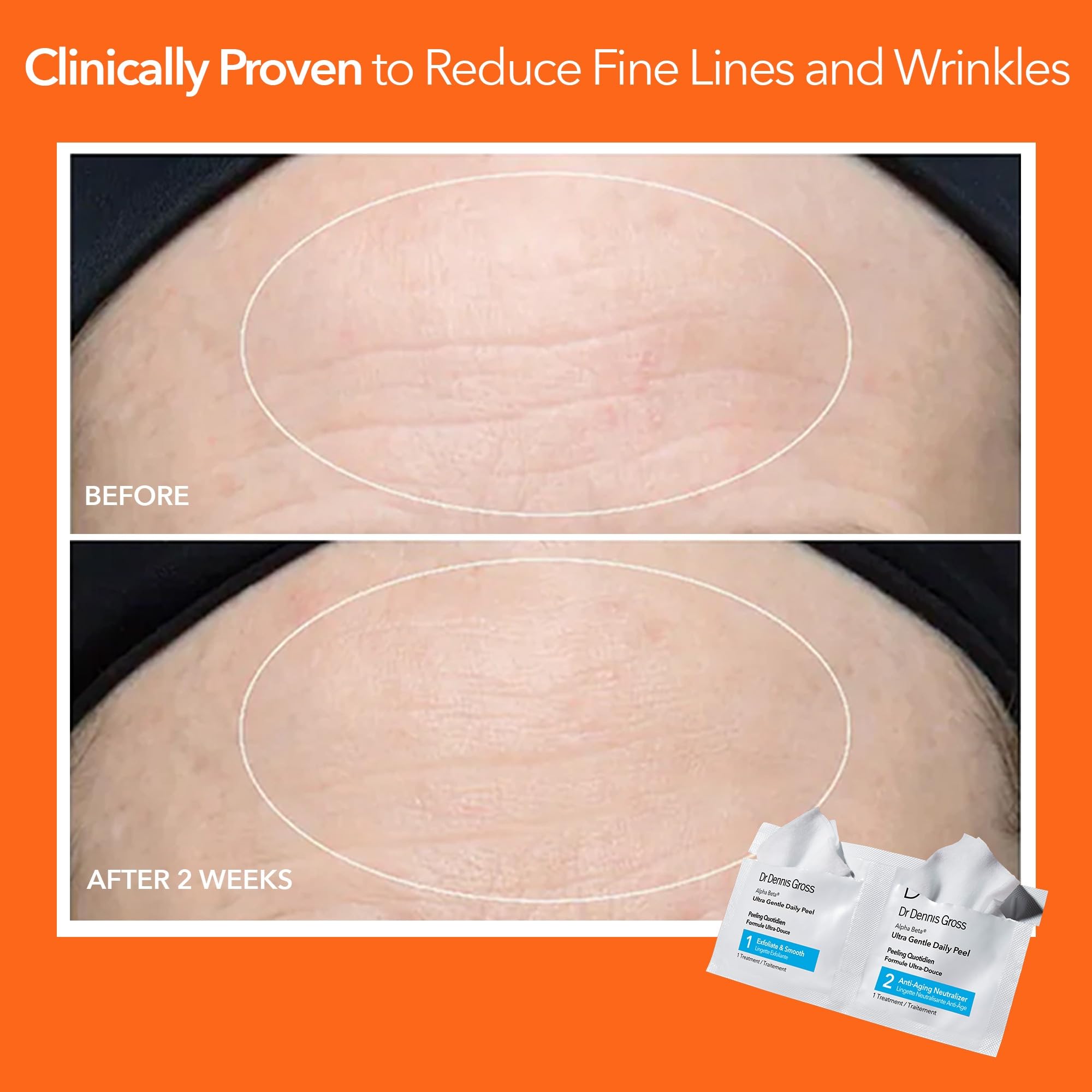 Dr Dennis Gross individually wrapped pads for hygienic, measured dosing