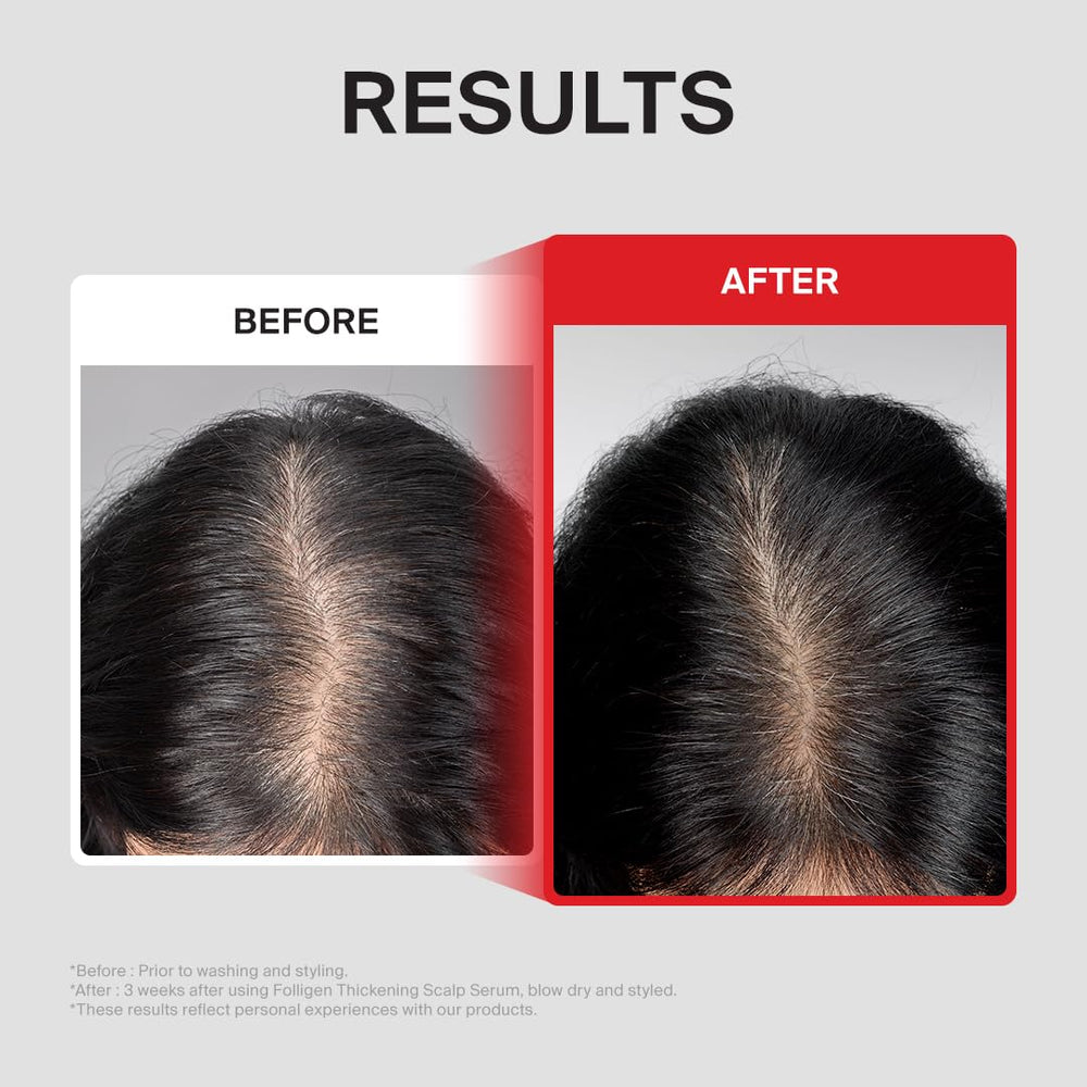 DR.FORHAIR label ingredients detail featuring biotin and peptide benefits