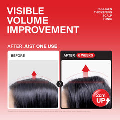 DR.FORHAIR application on scalp demonstrating easy non-greasy use