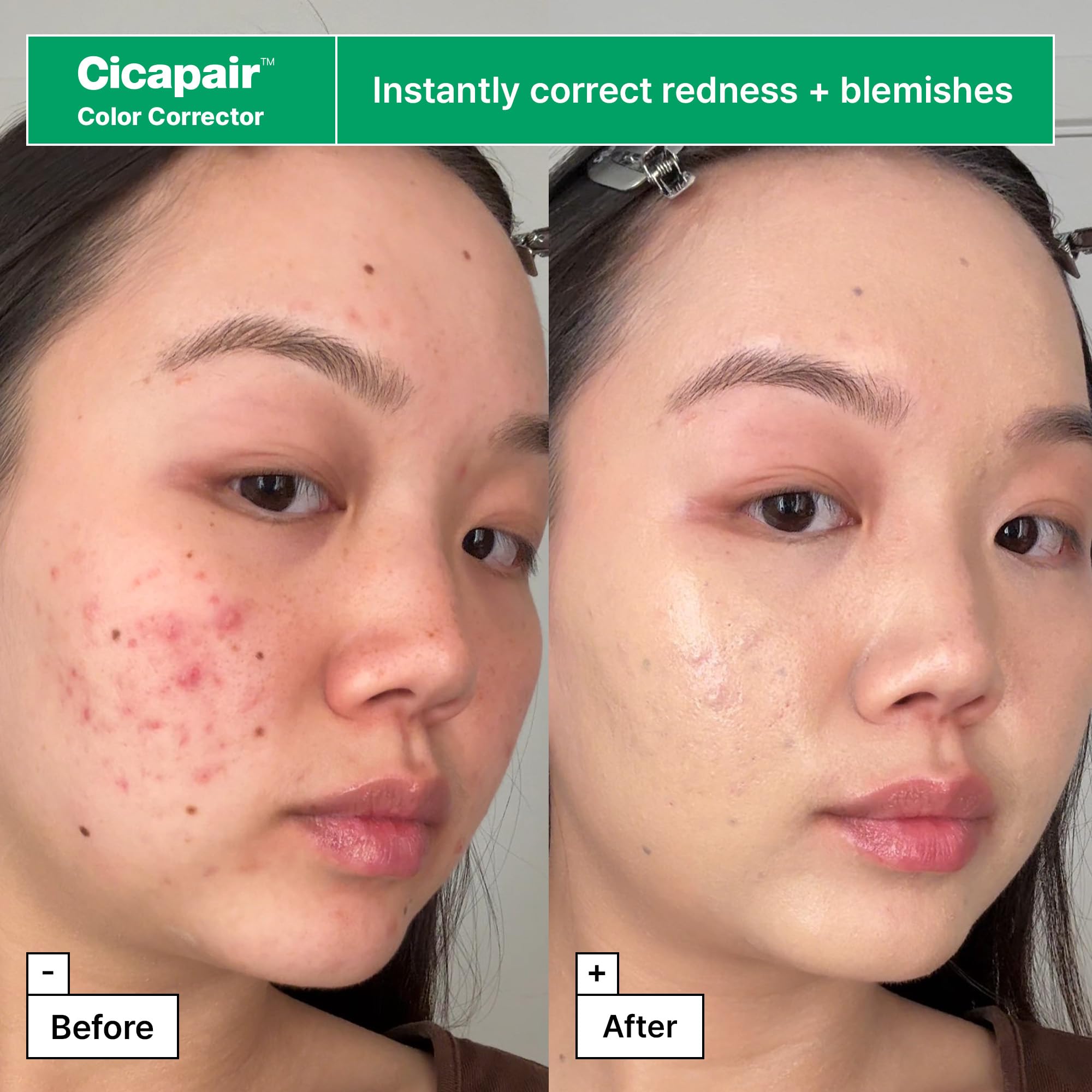 Dr.Jart+ serum drop on fingertip illustrating concentrated barrier-repair benefits