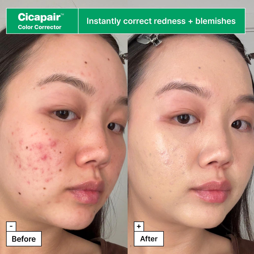 Dr.Jart+ serum drop on fingertip illustrating concentrated barrier-repair benefits