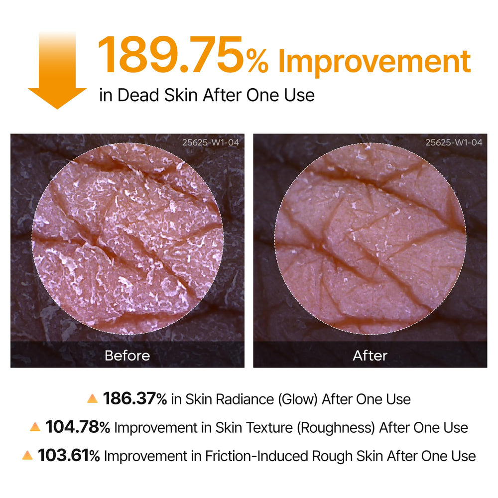 Dr.Melaxin before and after arms showing smoother, less bumpy skin