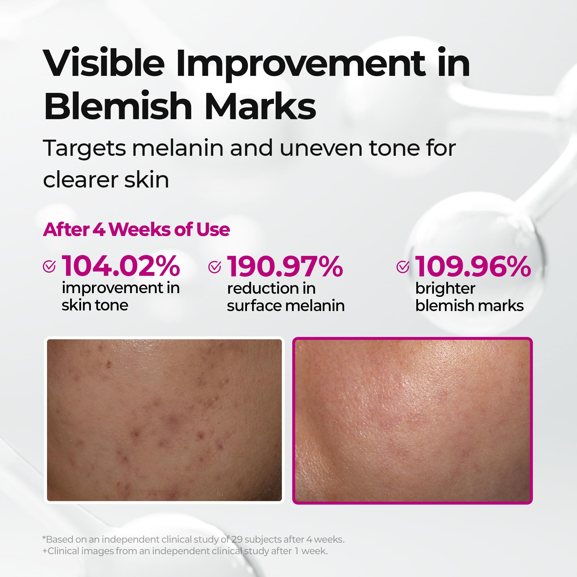 Dr.Melaxin before and after sample showing visible tone improvement